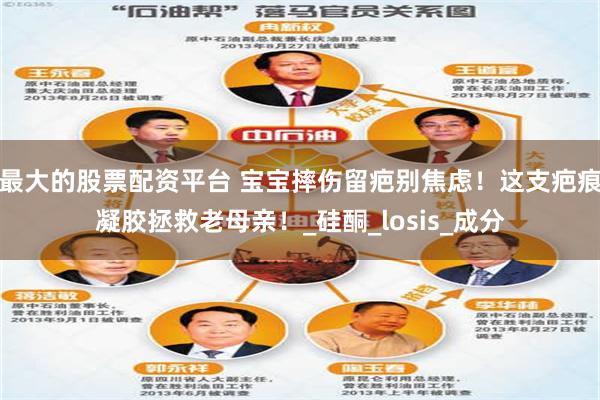 最大的股票配资平台 宝宝摔伤留疤别焦虑！这支疤痕凝胶拯救老母亲！_硅酮_losis_成分